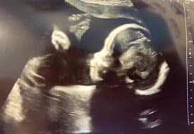 Ultrasound Image of Bosco Cooper